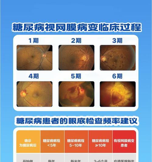 老花眼的症状有哪些？如何识别老花眼的早期信号？